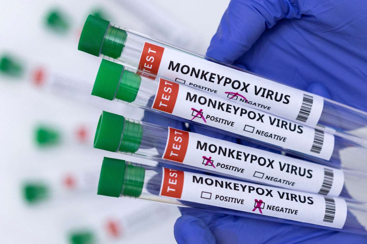 Variole du singe : la Haute Autorité de santé recommande de vacciner les cas contacts - Le Monde